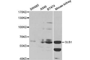 Western blot analysis of extracts of various cell lines, using GLB1 antibody (ABIN5970957) at 1/1000 dilution. (GLB1 anticorps)