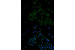 Immunofluorescence analysis of A549 cell using ARF6 antibody. (ARF6 anticorps)