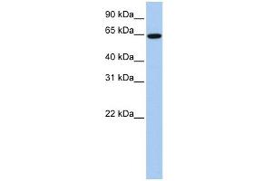 EPS8L1 antibody used at 1 ug/ml to detect target protein. (EPS8-Like 1 anticorps  (Middle Region))