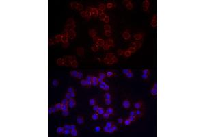 Immunofluorescence analysis of Raji cells using CD86 Rabbit pAb (ABIN3021700, ABIN3021701, ABIN3021702, ABIN1512724 and ABIN6215549) at dilution of 1:200 (40x lens).