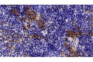 Detection of S100A8 in Mouse Spleen Tissue using Polyclonal Antibody to S100 Calcium Binding Protein A8 (S100A8) (S100A8 anticorps  (AA 1-89))