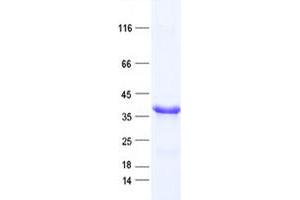 Validation with Western Blot (C1ORF111 Protein (His tag))