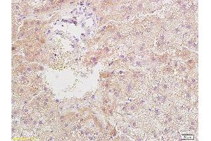 Formalin-fixed and paraffin embedded rat liver tissue with Anti-Resistin Polyclonal Antibody, Unconjugated  at 1:400, followed by conjugation to the secondary antibody and DAB staining (Resistin anticorps  (AA 21-114))