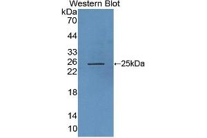 Figure. (RHAG anticorps  (AA 251-450))