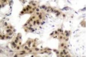 Image no. 2 for anti-Nuclear Factor of kappa Light Polypeptide Gene Enhancer in B-Cells 1 (NFKB1) (pSer893) antibody (ABIN318080)