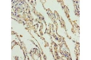 Immunohistochemistry of paraffin-embedded human lung tissue using ABIN7169988 at dilution of 1:100 (Solute Carrier Family 34 (Type II Sodium/phosphate Contransporter), Member 1 (SLC34A1) (AA 1-103) anticorps)