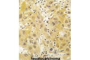 Immunohistochemistry (IHC) image for anti-TCDD-Inducible Poly(ADP-Ribose) Polymerase (Tiparp) antibody (ABIN3003615)