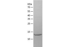 Western Blotting (WB) image for Fragile Histidine Triad (FHIT) (AA 1-147) protein (His-IF2DI Tag) (ABIN7123000)
