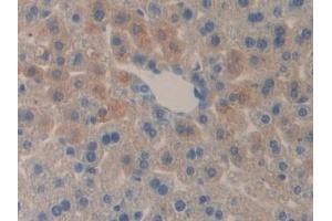 Detection of DLD in Mouse Liver Tissue using Polyclonal Antibody to Dihydrolipoyl Dehydrogenase (DLD) (DLD anticorps  (AA 45-271))