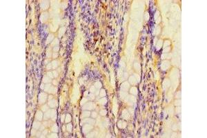 Immunohistochemistry of paraffin-embedded human small intestine tissue using ABIN7143485 at dilution of 1:100 (ARL15 anticorps  (AA 1-204))