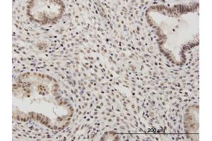 Immunoperoxidase of purified MaxPab antibody to RSC1A1 on formalin-fixed paraffin-embedded human endometrium. (RSC1A1 anticorps  (AA 1-617))