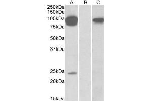 HEK293 lysate (10ug protein in RIPA buffer) overexpressing Human TRPV3 with DYKDDDDK tag probed with ABIN570683 (0. (TRPV3 anticorps  (AA 762-773))