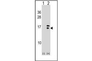 Western blot analysis of CRABP2 (arrow) using CRABP2 Antibody (C-term) Cat. (CRABP2 anticorps  (C-Term))