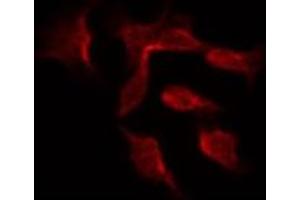 ABIN6266902 staining Hela by IF/ICC. (DGKH anticorps  (Internal Region))