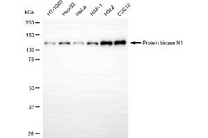 Western blotting analysis using protein kinase N1 antibody (ABIN7800005).