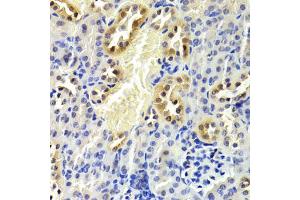 Immunohistochemistry of paraffin-embedded mouse kidney using CDKN1B Antibody. (CDKN1B anticorps)