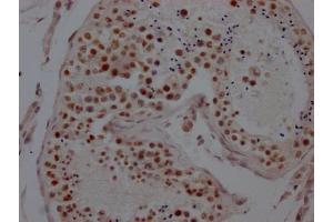IHC image of ABIN7127590 diluted at 1:100 and staining in paraffin-embedded human testis tissue performed on a Leica BondTM system.