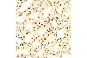 Immunohistochemistry of paraffin embedded rat kidney using RB1 (ABIN7075477) at dilution of 1:1400 (400x lens)