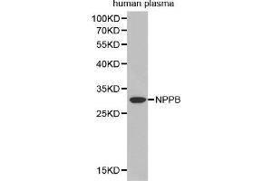 Western Blotting (WB) image for anti-Natriuretic Peptides B (NPPB) (AA 1-134) antibody (ABIN3023136) (NPPB anticorps  (AA 1-134))