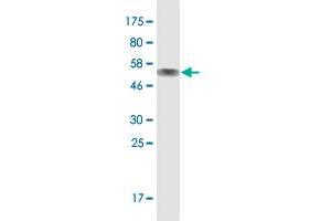 Western Blot detection against Immunogen (51.