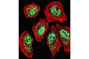 anti-Zinc Fingers and Homeoboxes 2 (ZHX2) (AA 105-131), (N-Term) antibody