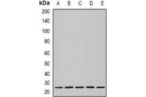 Western blot analysis of Nop30 expression in BT474 (A), MCF7 (B), mouse heart (C), mouse lung (D), rat heart (E) whole cell lysates. (NOL3 anticorps)