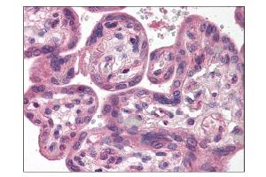 Image no. 1 for anti-SH3-Domain GRB2-Like Endophilin B1 (SH3GLB1) (C-Term) antibody (ABIN303245)