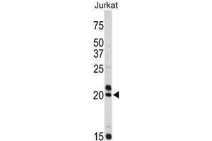 Western blot analysis of VIP antibody (C-term) in Jurkat cell line lysates (35ug/lane). (Vip anticorps  (C-Term))