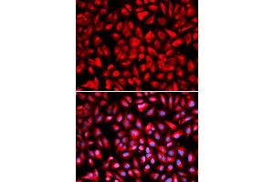 Immunofluorescence analysis of U2OS cells using IPO5 antibody.