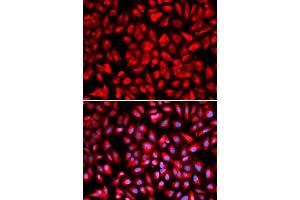 Immunofluorescence analysis of U2OS cells using IPO5 antibody. (Importin 5 anticorps  (AA 20-300))