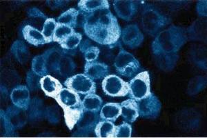 Immunofluorescent staining of A431 cells. (C-Raf-1 (AA 162-378) anticorps)