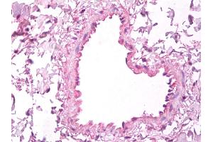 Anti-VEGF antibody IHC of human lung, vascular endothelium.