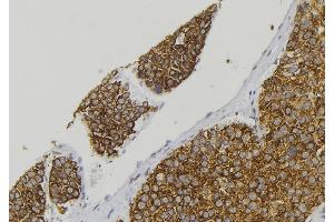 ABIN6278430 at 1/100 staining Human pancreas tissue by IHC-P. (CGRP anticorps  (Internal Region))