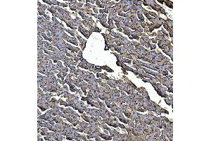 IHC analysis of EGFR using anti-EGFR antibody (ABIN7600915). (EGFR anticorps  (AA 25-596))