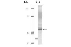 Western blot analysis using Akt3 monoclonal antibody against truncated Akt3 recombinant protein and human ovary carcinoma tissue lysate . (AKT3 anticorps  (truncated))