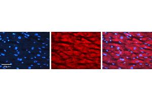 Rabbit Anti-LSP1 Antibody Catalog Number: AVARP00014_P050 Formalin Fixed Paraffin Embedded Tissue: Human heart Tissue Observed Staining: Cytoplasmic Primary Antibody Concentration: 1:100 Other Working Concentrations: N/A Secondary Antibody: Donkey anti-Rabbit-Cy3 Secondary Antibody Concentration: 1:200 Magnification: 20X Exposure Time: 0.