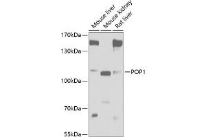 Western blot analysis of extracts of various cell lines, using POP1 antibody (ABIN6133335, ABIN6145961, ABIN6145962 and ABIN6221643) at 1:1000 dilution. (POP1 anticorps  (AA 1-210))