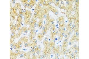 Immunohistochemistry of paraffin-embedded Human liver using ASGR1 Polyclonal Antibody at dilution of 1:100 (40x lens). (Asialoglycoprotein Receptor 1 anticorps)