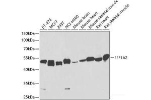 Western blot analysis of extracts of various cell lines using EEF1A2 Polyclonal Antibody at dilution of 1:1000. (EEF1A2 anticorps)