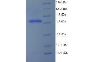 SDS-PAGE (SDS) image for Dihydrofolate Reductase (DHFR) (AA 2-187) protein (His-SUMO Tag) (ABIN5709401)