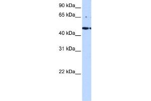 WB Suggested Anti-LYK5 Antibody Titration:  0. (STRADA anticorps  (C-Term))