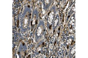 IHC analysis of USP44 using anti-USP44 antibody (ABIN7600640). (USP44 anticorps  (AA 211-712))