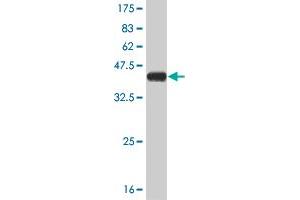 Western Blot detection against Immunogen (37. (STMN2 anticorps  (AA 73-179))