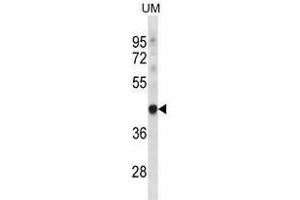 TRUB1 Antibody (Center) western blot analysis in UM cell line lysates (35 µg/lane). (TRUB1 anticorps  (Middle Region))