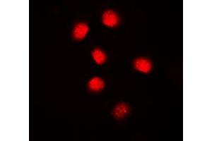 Immunofluorescent analysis of Cyclin E1 staining in MCF7 cells.