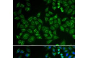 Immunofluorescence analysis of HeLa cells using SMPD1 / ASM Polyclonal Antibody (SMPD1 anticorps)