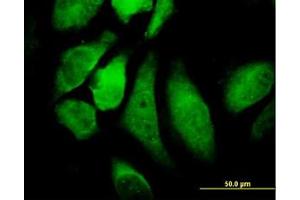Image no. 2 for anti-conserved Helix-Loop-Helix Ubiquitous Kinase (CHUK) (AA 646-745) antibody (ABIN598612) (IKK alpha anticorps  (AA 646-745))