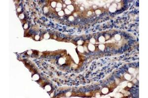 IHC testing of FFPE rat intestine with POR antibody. (POR anticorps)