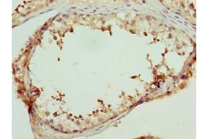 Immunohistochemistry of paraffin-embedded human testis tissue using ABIN7158142 at dilution of 1:100 (LRRC18 anticorps  (AA 1-261))