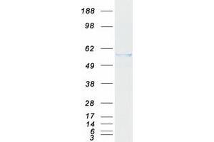 Validation with Western Blot